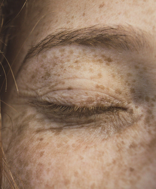 We look at how can Seaweed cosmetics help with Psoriasis