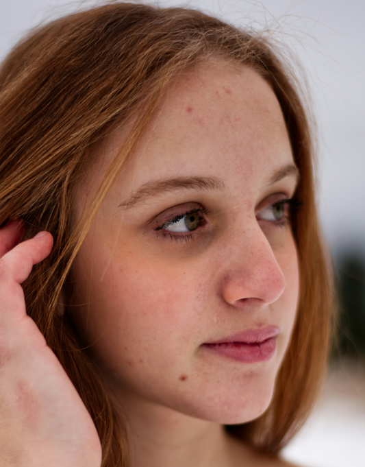 We look at how Seaweed Cosmetics can help teenage and acne prone skin 